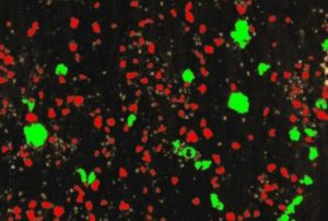 החלקיקים הגדולים גורמים לעיכול איטי