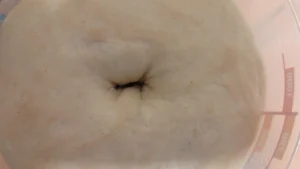 בצק עם ויטמין סי לאחר מבצע אצבע